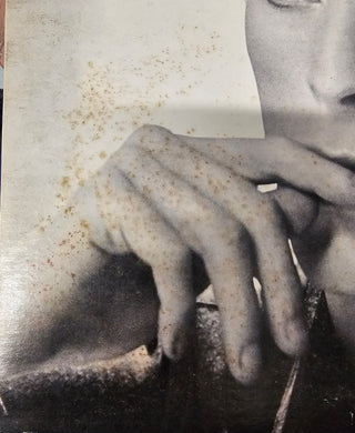 David Bowie- ChangesOneBowie (Sleeve Staining)