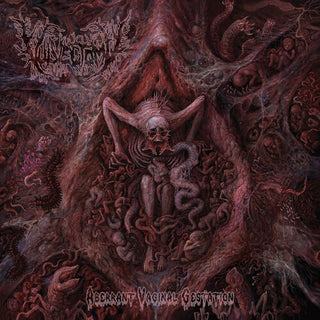 Vulvectomy- Aberrant Vaginal Gestation