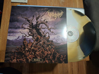 Vulvodynia- Entabeni
