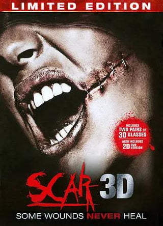 Scar 3D