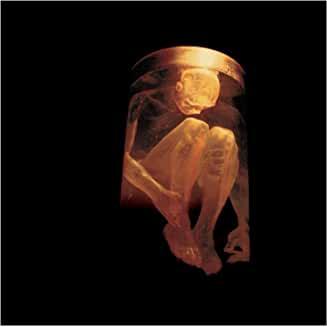Alice In Chains- Nothing Safe - DarksideRecords