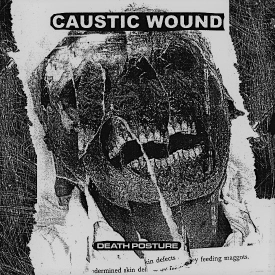 Caustic Wound- Death Posture